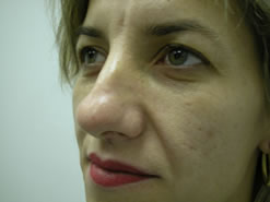 Before Image: Patient # 90921 - 