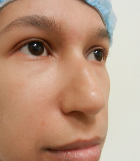 Before Image: Patient # 71624 - 