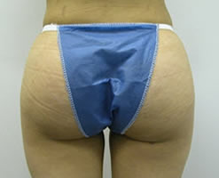 After Image: Patient # 56076 - 