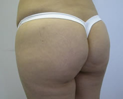 After Image: Patient # 49714 - 