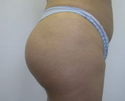 After Image: Patient # 19239 - 