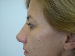 After Image: Patient # 90921 - 