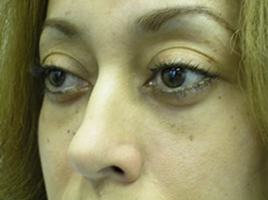 After Image: Patient # 72282 - 