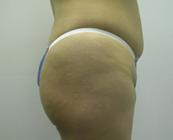 Before Image: Patient # 19239 - 