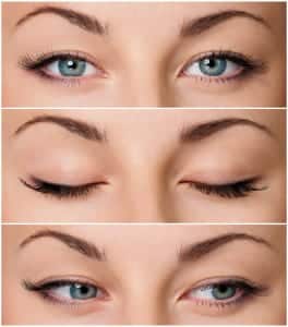 Eyelid Surgery Chicago IL