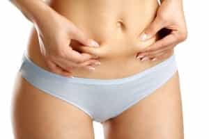 Tummy Tuck with Lipo Chicago IL